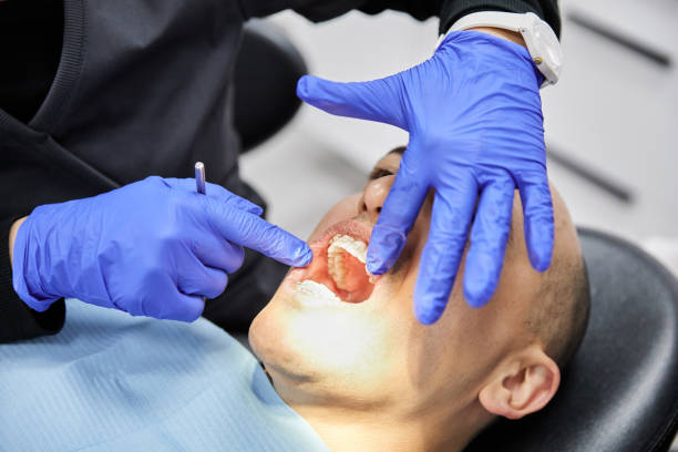 Best Broken or Cracked Tooth Emergency Dentist in Mallory, WV